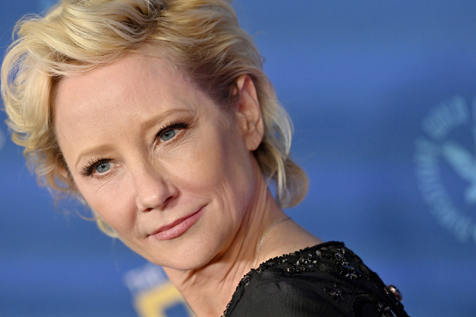Meghalt Anne Heche, miután súlyos autóbalesetet szenvedett